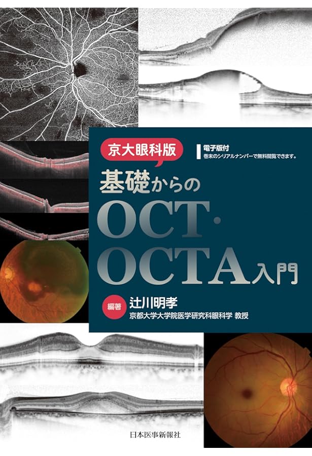 新OCT・OCTA読影トレーニング−改訂第2版 | 飯田 知弘, 森實